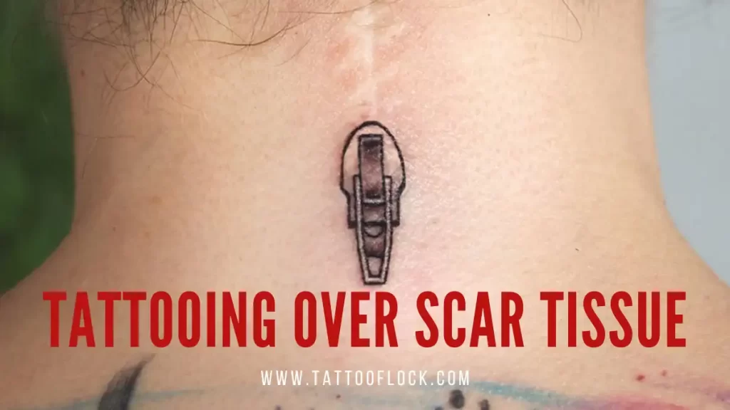 Tattooing Over Scar Tissues 1